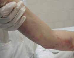 Nuove foto choc della morte di David Rossi