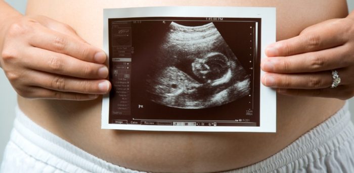 Il paradosso della sanit&agrave;: posto per l'ecografia in gravidanza quando il tempo &egrave; gi&agrave; scaduto