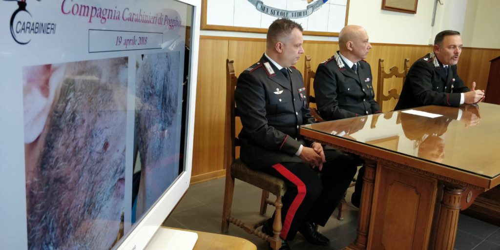 Sfregiato con l'acido su ordine dei suoceri