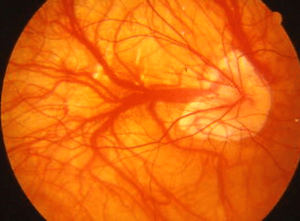 "Insieme per vederci meglio. Lavoriamo contro la degenerazione maculare senile'',  oggi il convegno di UICI Siena