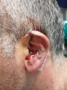 Ranza: poliziotto aggredito da detenuto, Salvini mostra le immagini: "Bonafede si occupi degli agenti"