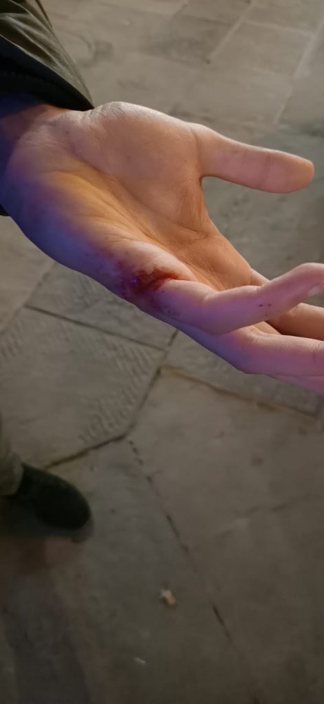 Pestato senza motivo da una banda in pieno centro a Siena, il racconto della vittima dell'aggressione