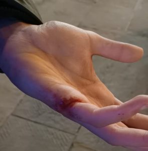 Pestato senza motivo da una banda in pieno centro a Siena, il racconto della vittima dell'aggressione