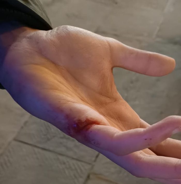 Pestato senza motivo da una banda in pieno centro a Siena, il racconto della vittima dell'aggressione