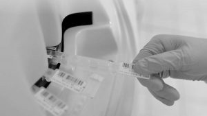 Diesse Diagnostica lancia il test SARS-CoV-2 "Neutralizing"