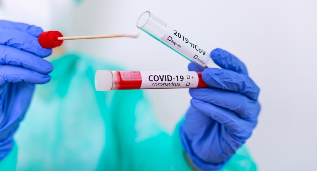 Test Covid-19 per accesso a strutture sanitarie o per ricovero: chi li deve fare e quando