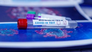 Coronavirus, 195 i nuovi casi positivi. Cinque decessi alle Scotte