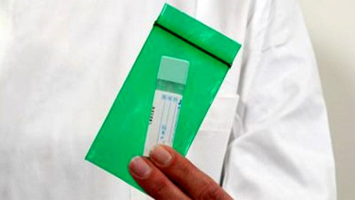 Siena, cambiano modalit&agrave; di ritiro e riconsegna dei kit per screening colon-retto