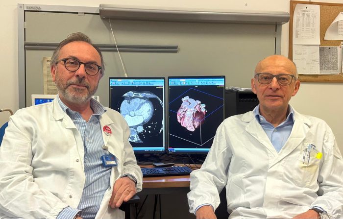 Tc coronarica a Nottola, dal 2023 sono stati effettuati circa 500 esami